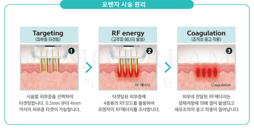 [크기변환]포텐자4