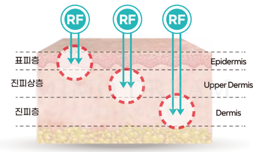 [크기변환]포텐자5